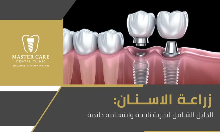 زراعة الاسنان: الدليل الشامل لتجربة ناجحة وابتسامة دائمة